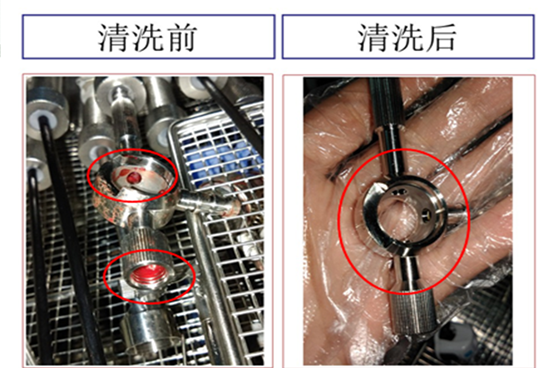 真空超(chao)声波清洗机,轻松解决(jue)医疗器械清洗难题